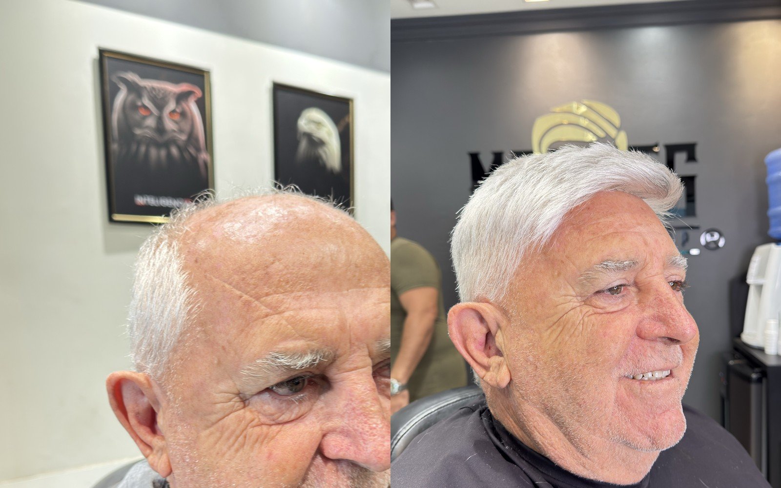 Antes e depois prótese capilar masculina Colatina, vista de perfil 2