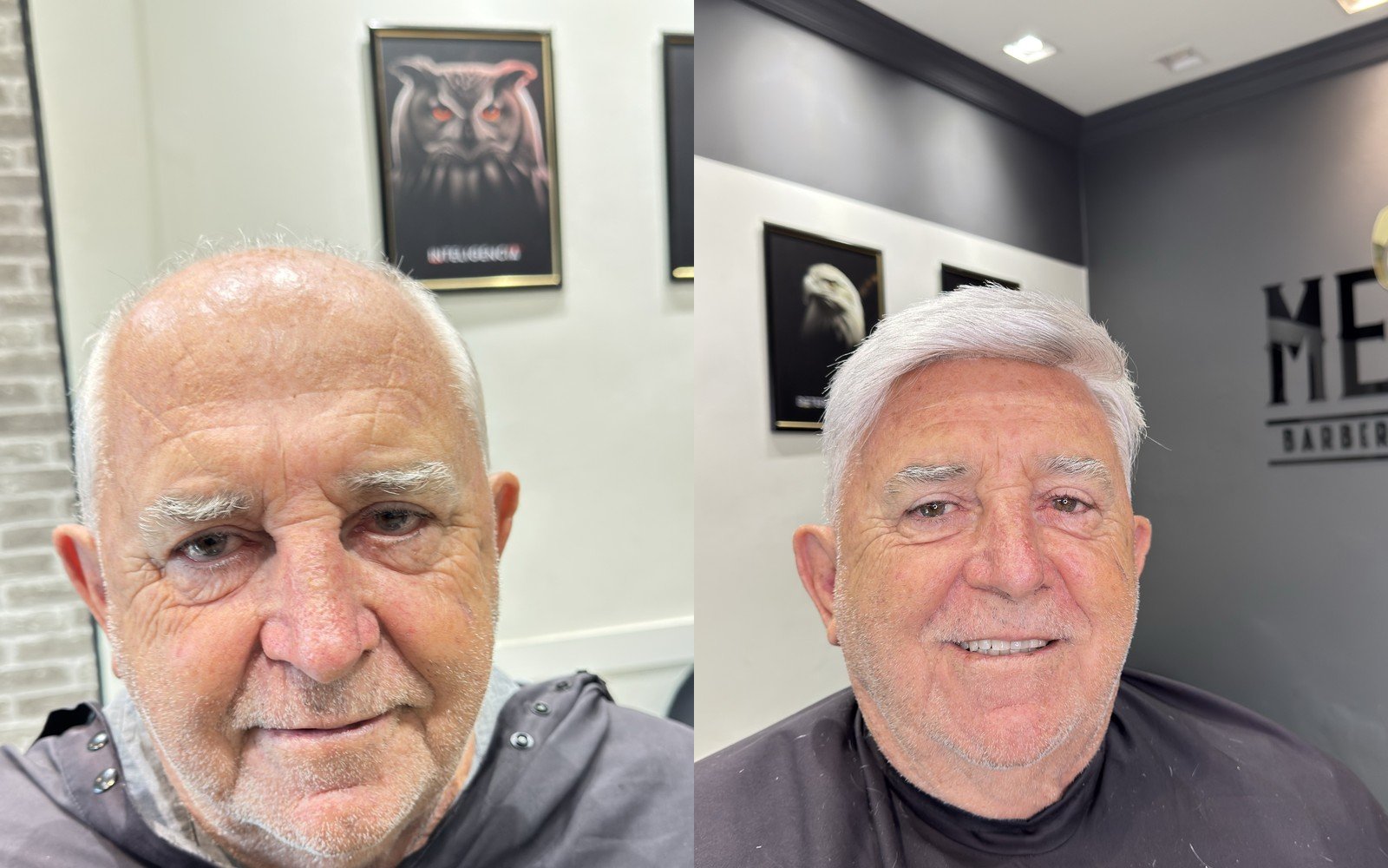 Antes e depois de prótese capilar masculina na Mendes Barber, Colatina-ES